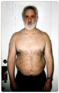 Marty before